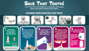 Save that tooth | HSE | dental trauma | front teeth broken |